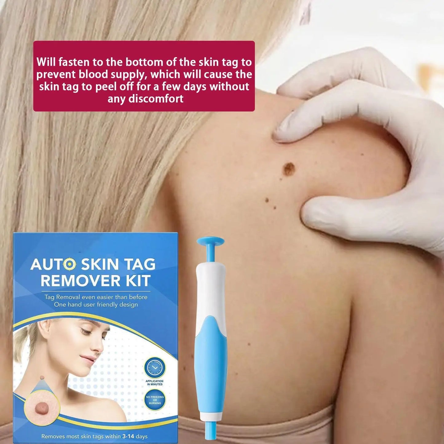 2 in 1 Skin Tag Remover Device Painless Mole Wart Remover Equipment Skin Tag Treatments Tool Skin Tags Removal Device